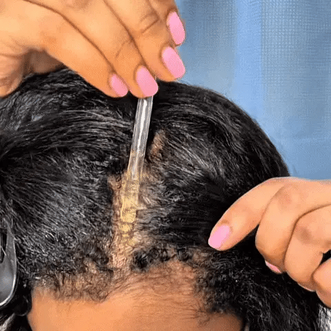 Calmova™ Olejek Wzrostu Włosów – Naturalna Regeneracja i Gęstość.