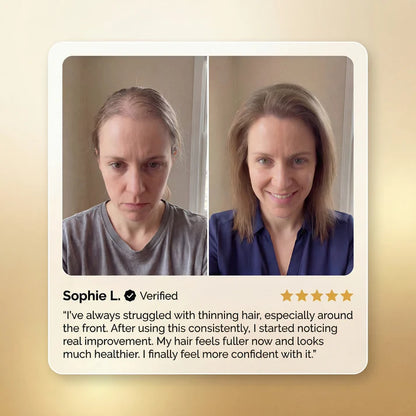 Calmova™ Olejek Wzrostu Włosów – Naturalna Regeneracja i Gęstość.