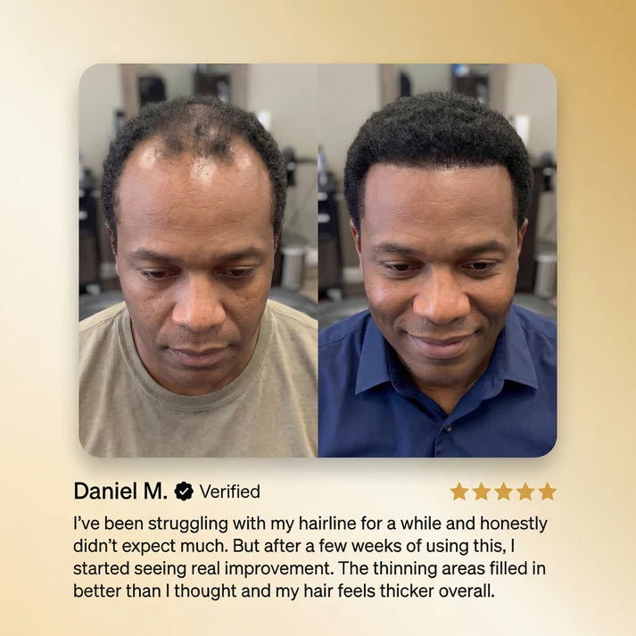 Calmova™ Olejek Wzrostu Włosów – Naturalna Regeneracja i Gęstość.